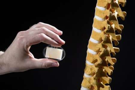 nanocomposite for bone substitution