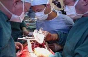 Organ donation